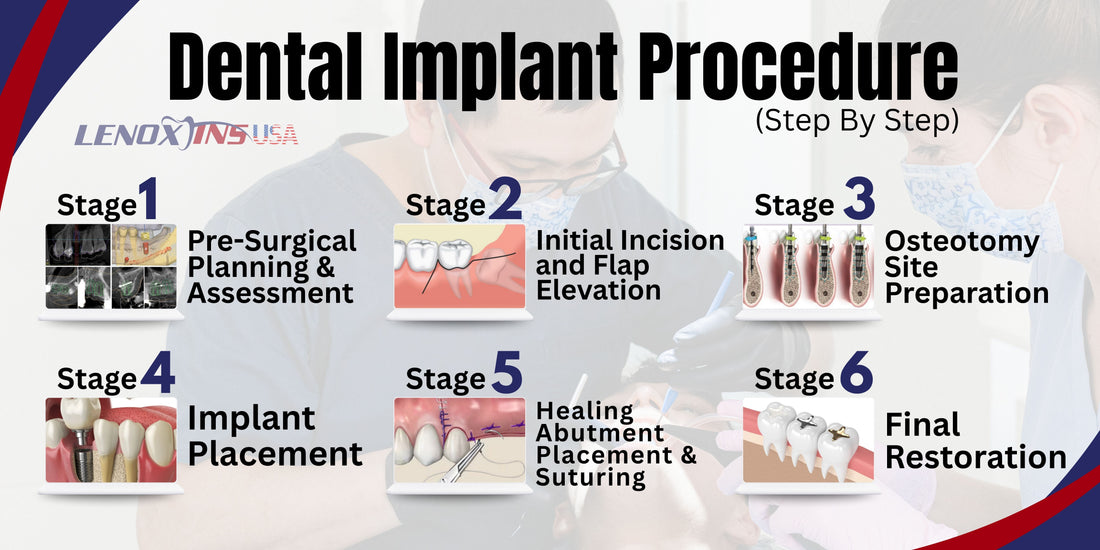 Step-by-Step Dental Implant Procedure – Key Tools Reviewed